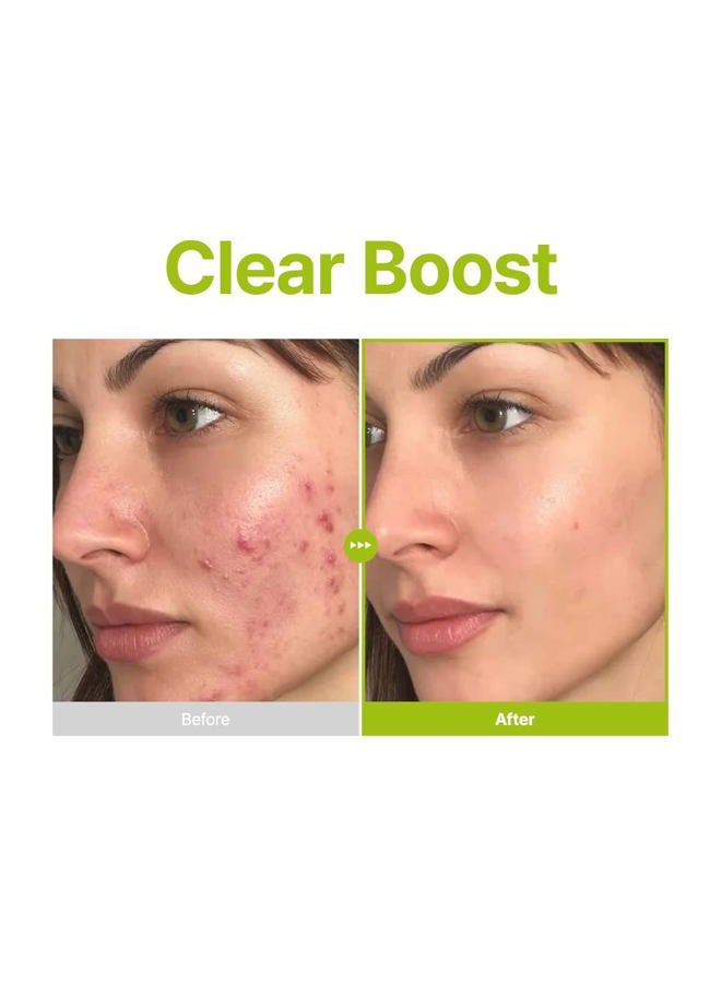 PURITO سيروم الوجه بحمض الأزيليك 10% + حمض الكوجيك + زيت شجرة الشاي | لعلاج حب الشباب والندبات، والبثور | مستوى عالي من حمض الأزيليك 10% | العناية بالبشرة الكورية، 30 مل 1.01 أونصة سائلة - Image 5